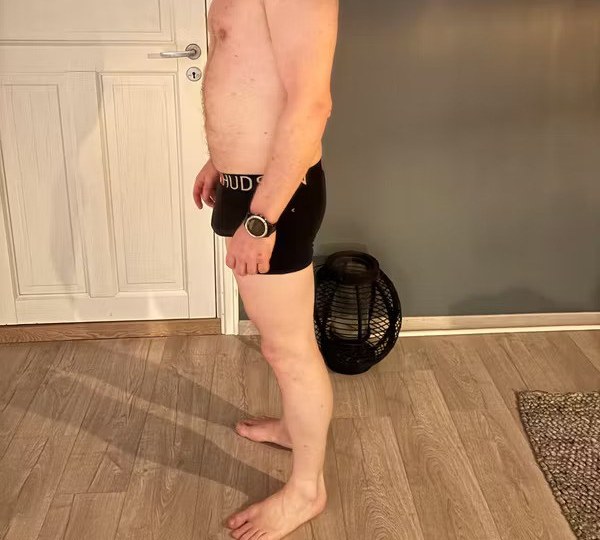 Mann 49 år etter kurset – ned 13 kg og 62 cm i total omkrets, anonymisert